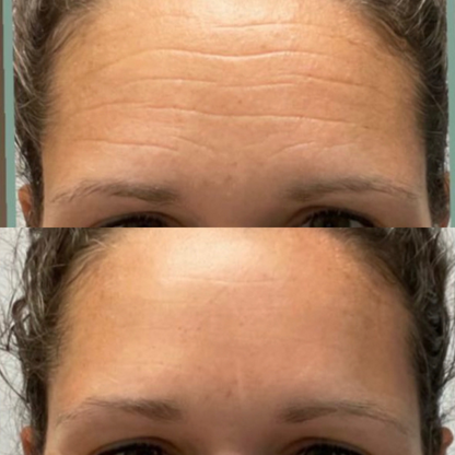 Cinta para frente selladora Bare™ Serum