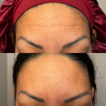 Cinta para frente selladora Bare™ Serum
